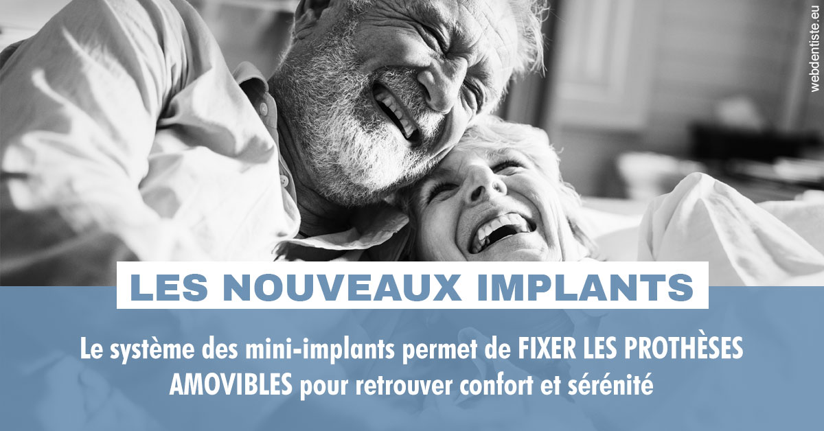https://dr-marchou-maxime.chirurgiens-dentistes.fr/Les nouveaux implants 2