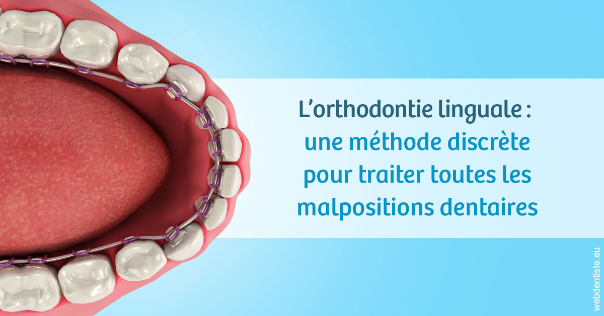 https://dr-marchou-maxime.chirurgiens-dentistes.fr/L'orthodontie linguale 1