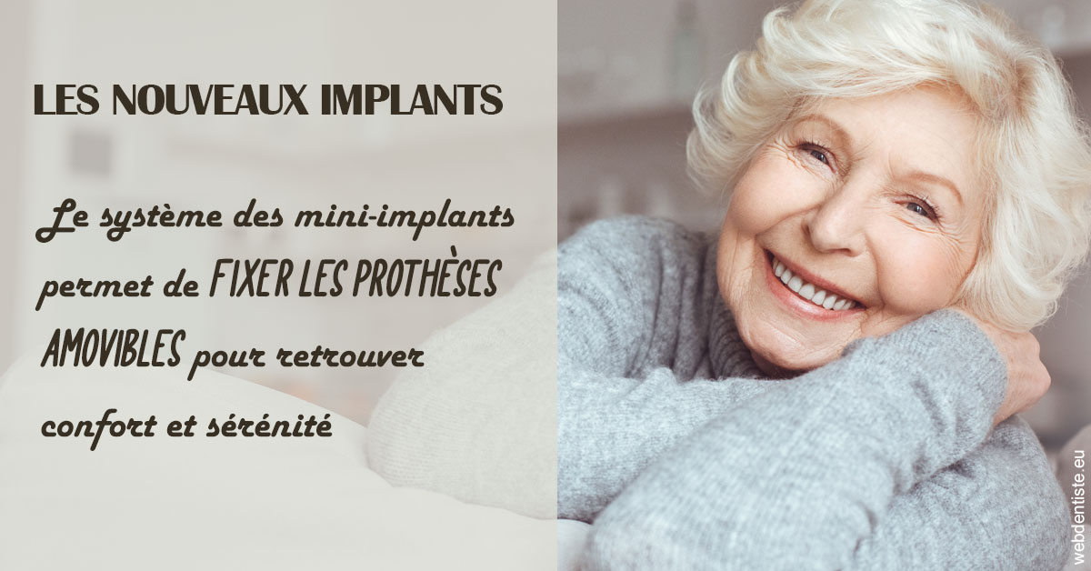 https://dr-marchou-maxime.chirurgiens-dentistes.fr/Les nouveaux implants 1