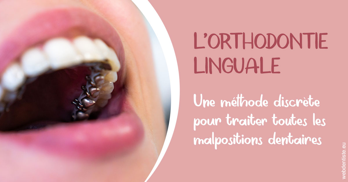 https://dr-marchou-maxime.chirurgiens-dentistes.fr/L'orthodontie linguale 2