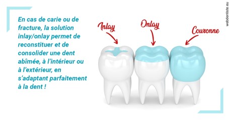 https://dr-marchou-maxime.chirurgiens-dentistes.fr/L'INLAY ou l'ONLAY