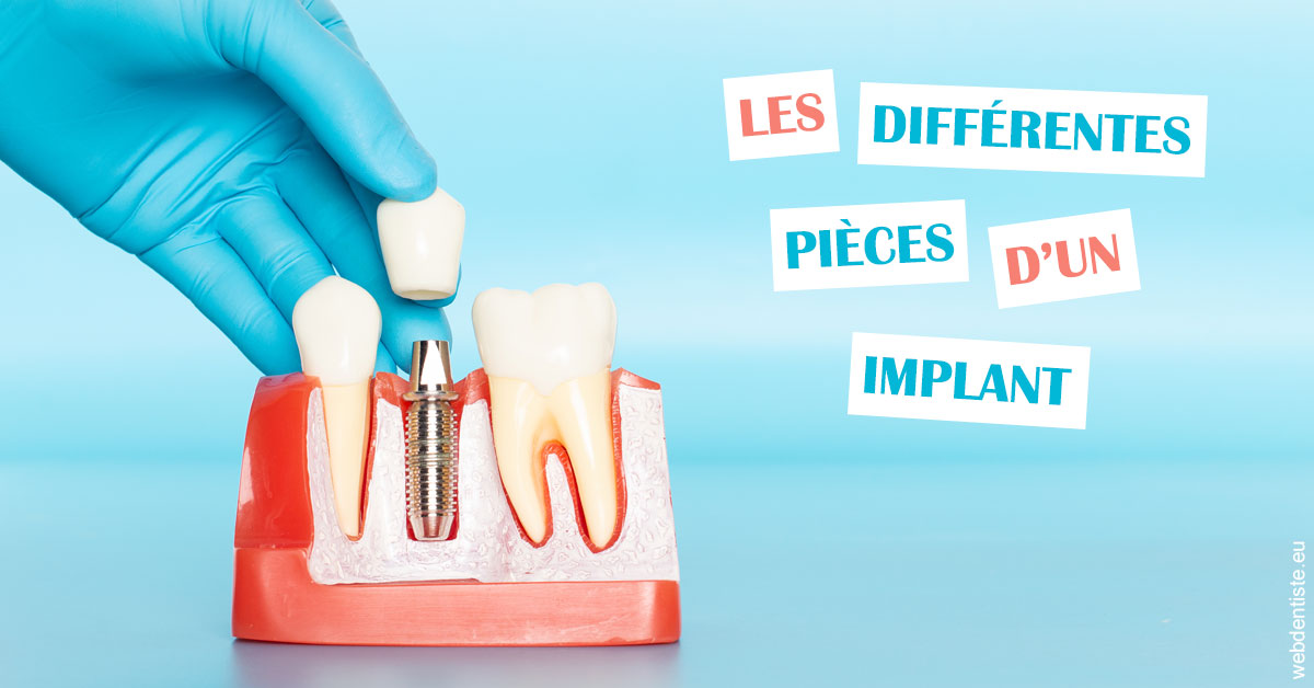 https://dr-marchou-maxime.chirurgiens-dentistes.fr/Les différentes pièces d’un implant 2