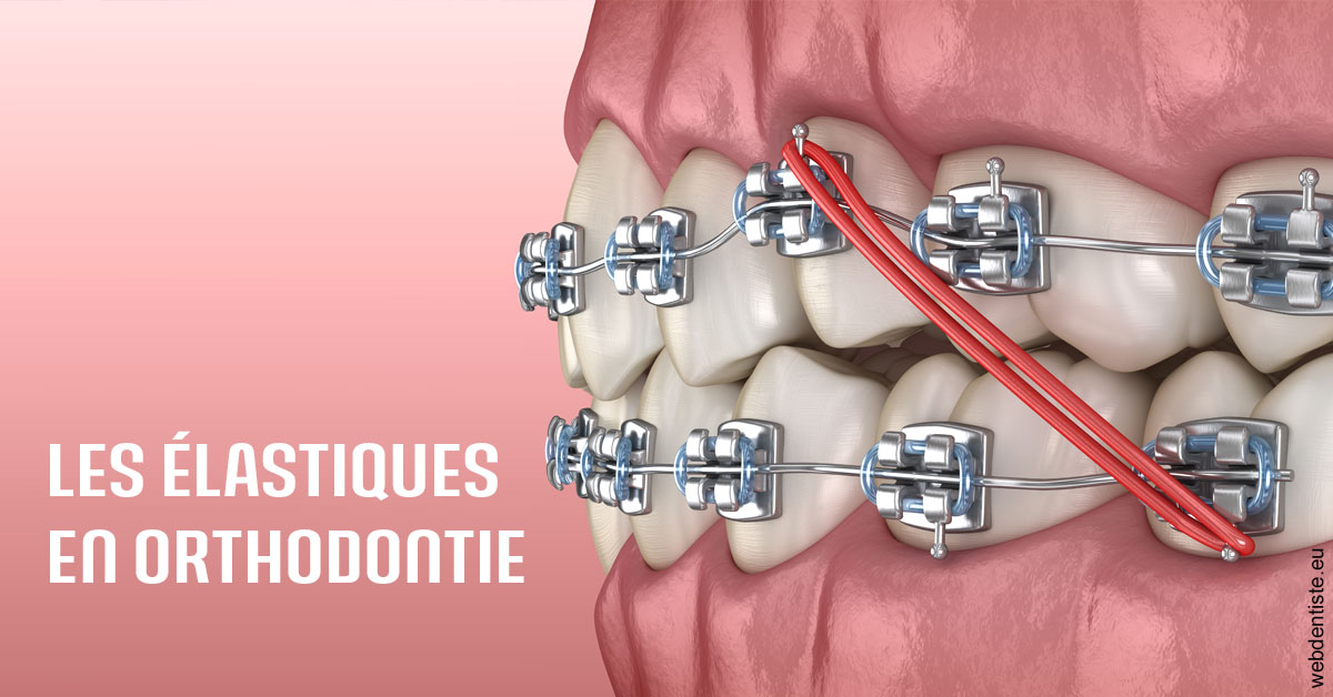 https://dr-marchou-maxime.chirurgiens-dentistes.fr/Elastiques orthodontie 2