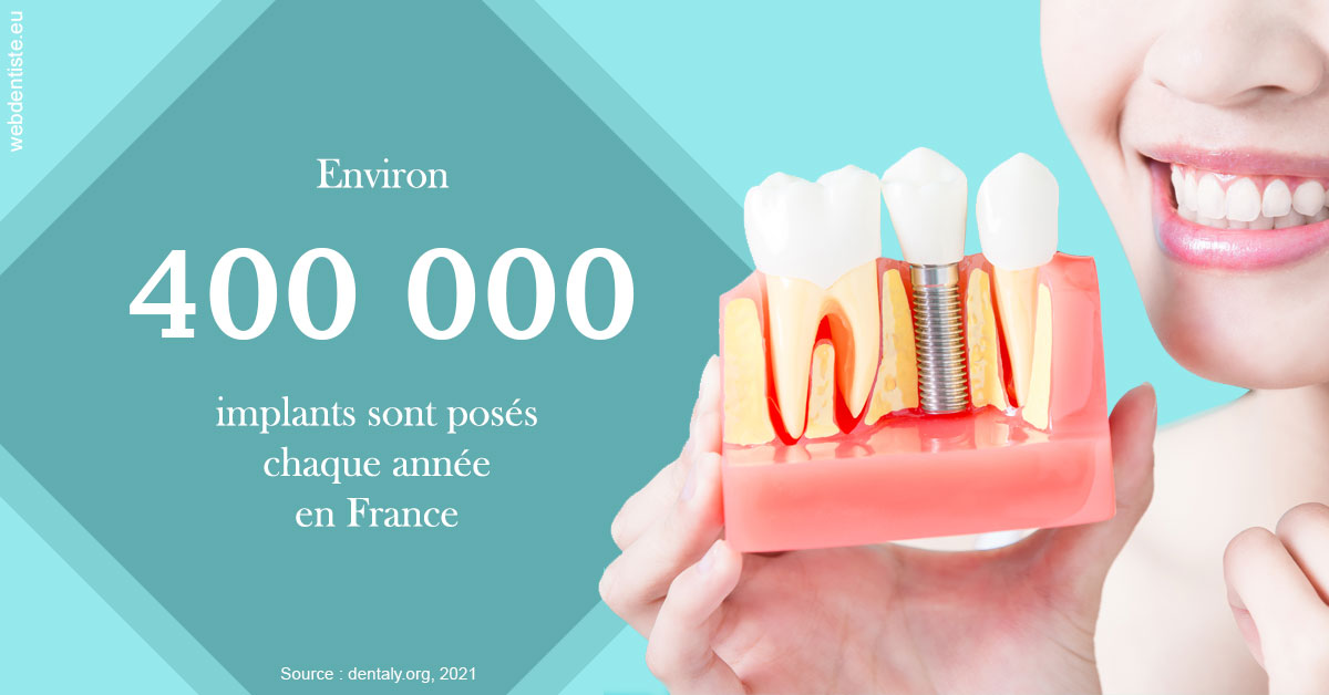 https://dr-marchou-maxime.chirurgiens-dentistes.fr/Pose d'implants en France 2