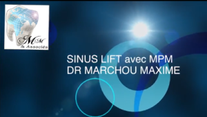DR MARCHOU - SINUSLIFT